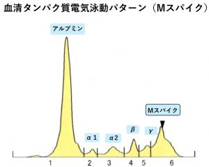 「総タンパク・アルブミンの異常」の原因ーMタンパクのお話 | 市川駅前本田内科クリニック