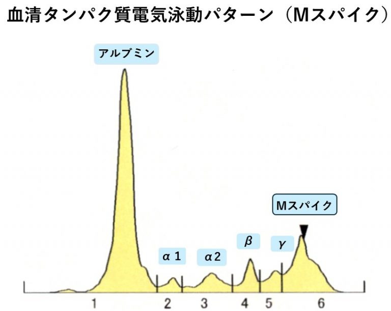 「総タンパク・アルブミンの異常」の原因ーMタンパクのお話 | 市川駅前本田内科クリニック
