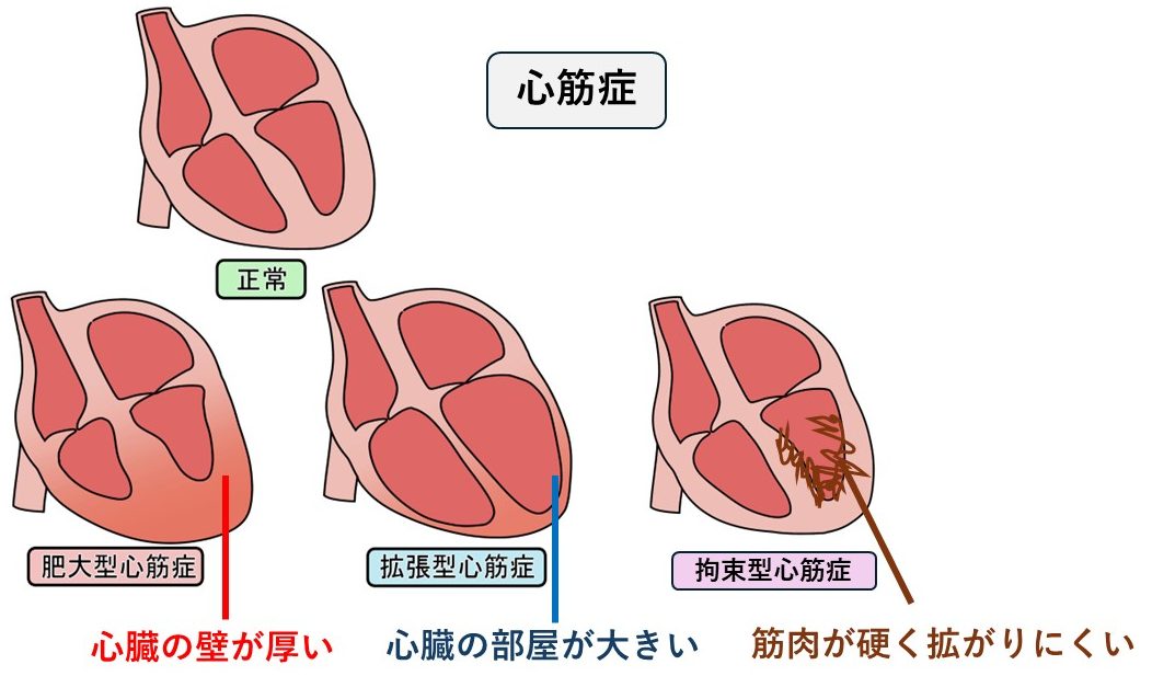 健診で心雑音を指摘されたら？原因・症状・受診の目安 | 市川駅前本田